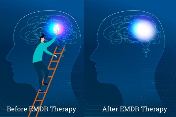 Healing fro Trauma - Before and after EMDR therapy - Insightful Counselling